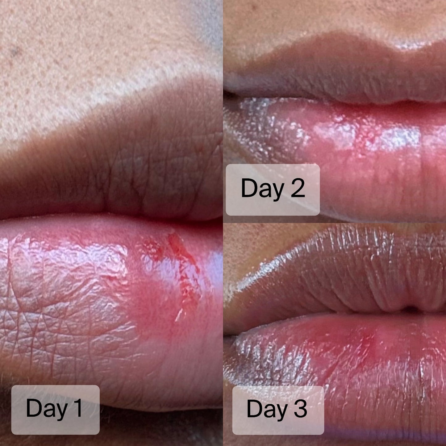 LIP BALM